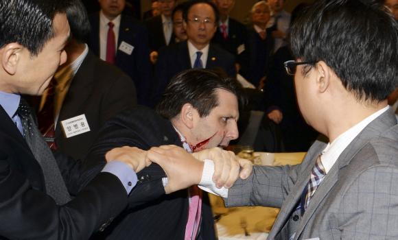 US Ambassador to Seoul Injured from Extremist’s Assault